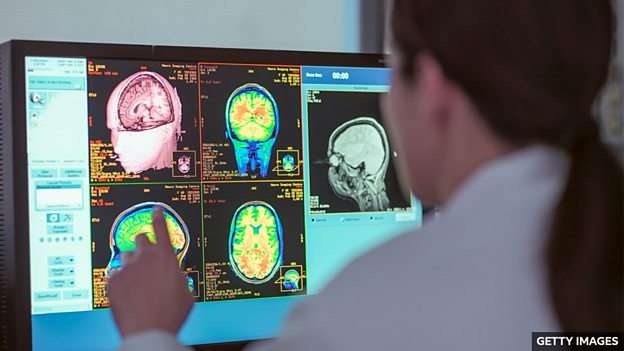 New study shows four pivotal ages for your brain