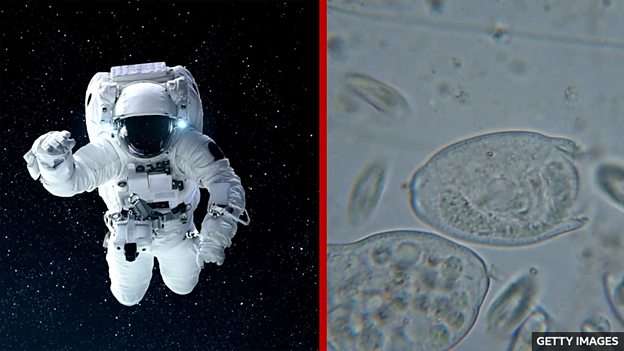Could alien life make us sick? 外星生命有可能让人类生病吗？
